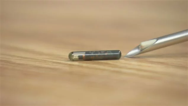 Chiens dangereux , la SPA plaide pour l’implantation de micropuces Chiens dangereux , la SPA plaide pour l’implantation de micropuces